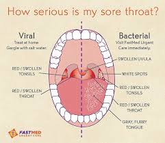 Image Result For Elementary School Nurse Sick Remedies Health Resources Good To Know