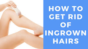 I have a lot of ingrown hair on my leg and. How To Get Rid Of Ingrown Hairs Full Guide Laserall