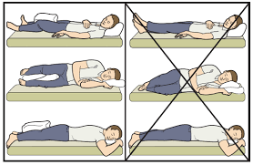 Figure 9 Sleeping Positions After A Hip Replacement Hip Replacement Surgery Hip Replacement Exercises Hip Replacement