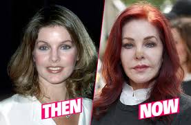 The latest news, photos and videos on priscilla presley is on popsugar celebrity. Priscilla Presley Ruins Looks After Skin Cancer Surgery Drama
