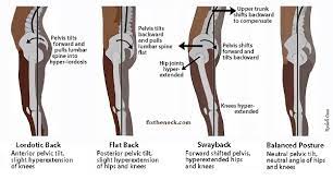 With a pseudo locked knee, usually, after resting in a comfortable position for a few moments and gently bending and straightening the knee, the knee will relax enough for you to be able to move it again. Knee Hyperextension Its All In Your Mind Ellie Herman Pilates
