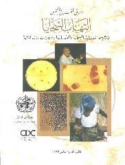 Meningitis is an umbrella term for five types of the disease, each characterized by its underlying cause. Ø§Ù„Ø·Ø±Ù‚ Ø§Ù„Ù…Ø®ØªØ¨Ø±ÙŠØ© Ù„ØªØ´Ø®ÙŠØµ Ø§Ù„ØªÙ‡Ø§Ø¨ Ø§Ù„Ø³Ø­Ø§ÙŠØ§ Ø§Ù„Ù†Ø§Ø¬Ù… Ø¹Ù† Ø§Ù„Ù†ÙŠØ³Ø±ÙŠØ§Øª Ø§Ù„Ø³Ø­Ø§Ø¦ÙŠØ© Ùˆ Ø§Ù„Ø¹Ù‚Ø¯ÙŠØ§Øª Ø§Ù„Ø±Ø¦ÙˆÙŠØ© Ùˆ Ø§Ù„Ù…Ø³ØªØ¯Ù…ÙŠØ§Øª Ø§Ù„Ù†Ø²Ù„ÙŠØ©