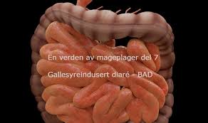 Mennesker som blir smittet av campylobacter, kan få høy feber, diaré og magesmerter, kvalme, oppkast og hodepine. En Verden Av Mageplager Del 7 Lmf Landsforeningen Mot Fordoyelsessykdommer