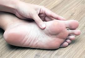 Corns and calluses on the feet are thickened areas of skin that can become painful. Corns And Calluses Treatment Symptoms Signs Causes