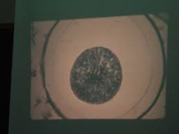 Microviewer lab animal cell mitosis. Animal Mitosis Ascaris Flashcards Quizlet