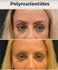 🧬 Say Goodbye to Tired Eyes