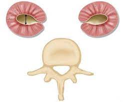 Your Baby S Kidneys Hydronephrosis Pelviectasis Golden Gate Obstetrics Gynecology