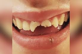 Pourquoi vouloir encore une fois faire semblant de rentrer dans le moule? Lyon Je N Avais Plus De Dents Devant Juliette 19 Ans Raconte L Agression Dont Elle A Ete Victime En Pleine Rue