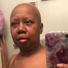 Fundraiser by Lisa Vassell : Medical Bills