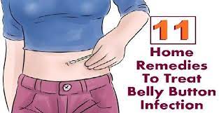 11 Effective Home Remedies To Treat Belly Button Infection Yeast Infection Home Remedy Home Remedies Remedies