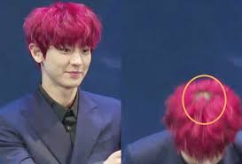 So Are There Actually Male Idols Who Are Going Bald Allkpop Forums