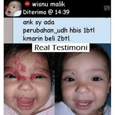 We did not find results for: Cod Obat Hemangioma Penghilang Hemangioma Penghilang Tanda Lahir Merah Aman Untuk Bayi Ampuh Shopee Indonesia