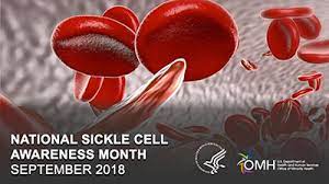 September Is Sickle Cell Disease Awareness Month Rutgers Cancer Institute Of New Jersey