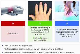 What are the 5 types of psoriatic arthritis. Psoriatic Arthritis Mnemonic It S As Easy As Psa 30 Photograph Of Download Scientific Diagram
