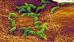 أسرع وأقوى علاج طبيعي لجرثومة المعدة موقع قناة المنار لبنان