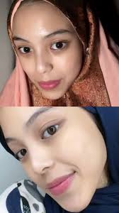 Manfaat Niacinamide untuk Kulit Cerah dan Merata