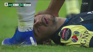 El '10' de colombia presentó doble lesión en su rodilla derecha. Nicolas Benedetti Ultimas Noticias Videos Y Fotos De Nicolas Benedetti Tudn Univision