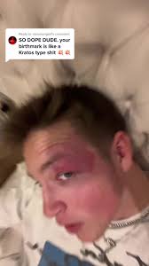 Unique Birthmark Gym Motivation