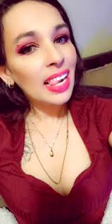 I'm 2 weeks and 3 days post op and I feel amazing... I'm still adjusting to  not hiding my teeth and relearning how to smile but I know it will only get  better from here! Fun fact I have never worn ...