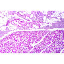 Image result for tonsilla palatina