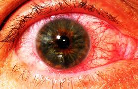 Pin On Eyes
