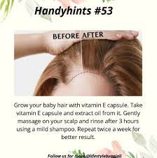 Pin By Renu Singh On Handyhints Hair Care Natural Skin Care Hair Care Remedies
