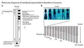 In vertebrates, somites subdivide into the sclerotomes, myotomes, syndetomes and dermatomes that give rise to the vertebrae of the vertebral column, rib cage and part of the occipital bone; Illustration Of The Process Of Somite Formation From The Presomitic Download Scientific Diagram