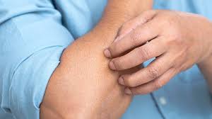 Image result for itchy skin rectum