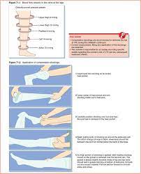 Application And Use Of Compression Stockings Nurse Key