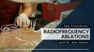Image result for Radiofrequency Surgery