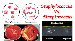 Differences Between Staphylococcus And Streptococcus