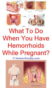 Pin On How To Tell If You Have Hemorrhoids