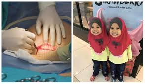 Harap korg sudi dan boleh sedut pengalaman mayra ni. Bersalin Anak Kembar Secara Normal Caeseran Serentak Wanita Ini Kongsi Pengalaman Mendebarkan