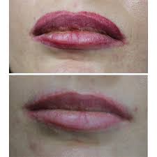 Avoid makeup on and around the brows for 24 hours. Tattoo Removal Examples Semi Permanent Makeup By Dasha