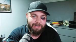 The moment Rio Ferdinand's YouTube channel host Stephen Howson throws  punches and a headbutt as he sparks a Sunday League football brawl, which  left him with a nasty black eye