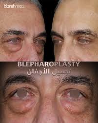 Image result for Blepharis transvaalensis