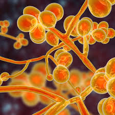 Image result for Buchnera candida