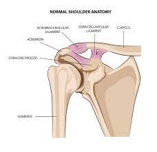 A grade 2 injury will involve complete rupture of the acromioclavicular ligament and partial tear of the coracoclavicular ligament. Auckland Shoulder Clinic Injured Your Ac Joint