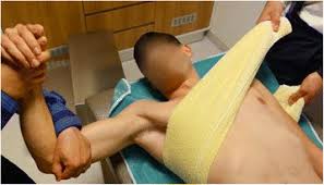 Image result for Shoulder Relocation Maneuvers