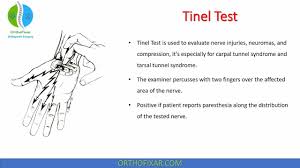 Image result for Carpal Compression Test