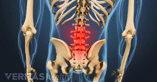 Find & download the most popular back bone photos on freepik free for commercial use high quality images over 8 million stock photos. Spinal Osteoarthritis Symptoms
