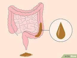 Dans un premier temps, cette infestation n'entraîne pas toujours de manifestation particulièrement visible. Comment Savoir Si L On A Des Vers Avec Images