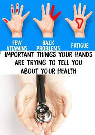 Hands Important Things Your Hands Are Trying To Tell You About Your Health Numbness In Hands Numbness In Fingers Health Humor