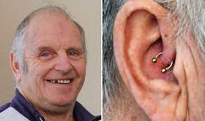Can Earrings Cure Migraines Pensioner Finds Relief After 50 Years Uk News Express Co Uk