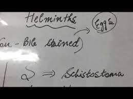 Microbiology Helminths Non Bile Stained Eggs Mneumonic Youtube