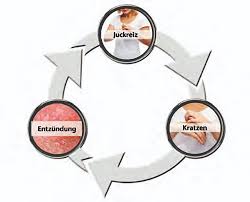 In verschiedenen studien wurde berechnet, dass nach 10 bis 14 tagen 95 prozent der infizierten krankheitszeichen entwickelt hatten. Windpocken Gurtelrose Infectopharm Wissen Wirkt