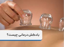 بادکش چیست؟ بررسی علمی و سنتی یک روش درمانی