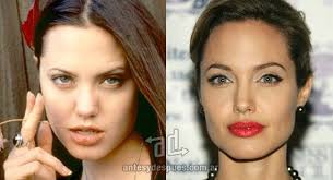Celebrities With Plastic Surgery Celebrity Plastic Surgery Plastic Surgery Bad Plastic Surgeries
