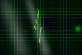 It is a graph of voltage versus time of the electrical activity of the heart using electrodes placed on the skin. Das Ekg Was Sieht Der Arzt Kkle De