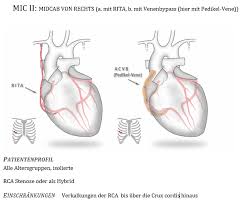Oooooooohooooopoopjopopopopoposop sfhl os os yd yd ts qi wo (y ra wo tos. Bypass Chirurgie Grosstes Kommunales Krankenhaus In Nrw